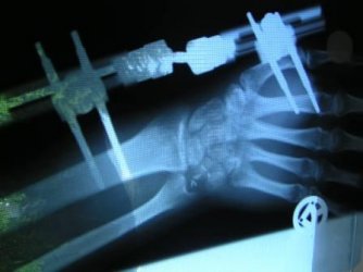 Hand 1.jpg